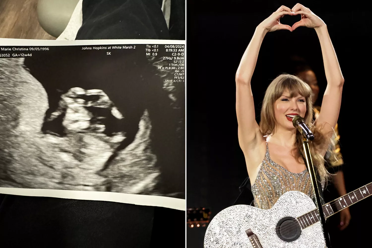 Baby makes Taylor Swift Heart Hands in sonogram