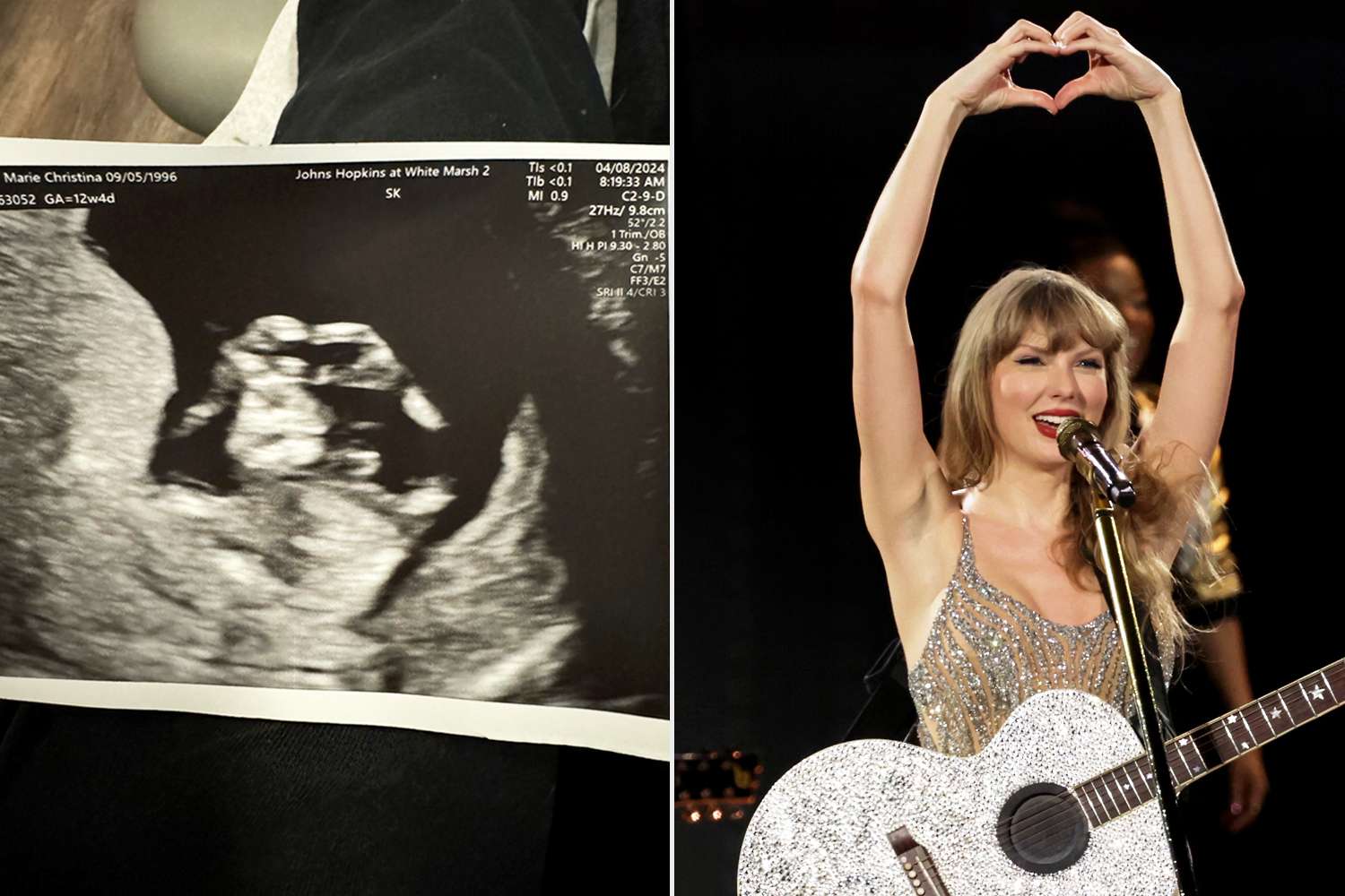 Baby's Hands Make Taylor Swift's 'Heart Hands' in Sonogram (Exclusive)